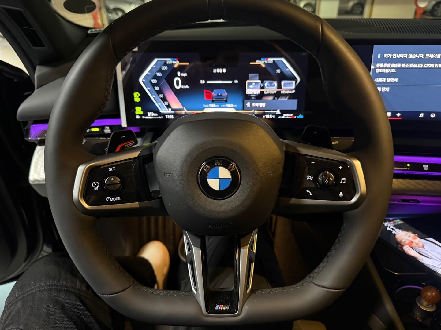 520i M KIT